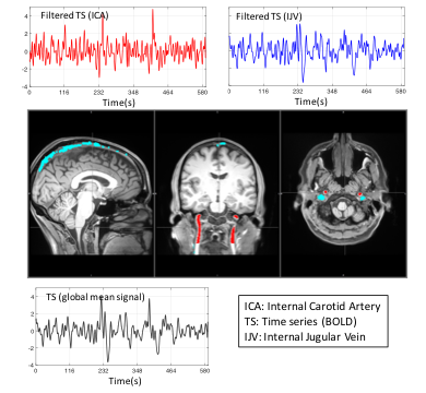 Using BOLD fMRI signal to understand the origin of physiological low frequency oscillations