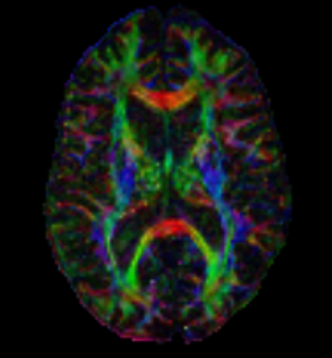 DTI_color_map.png