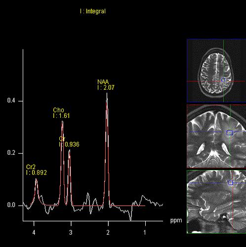 MRI Spectrum of the Human Brain, two sequence comparison.