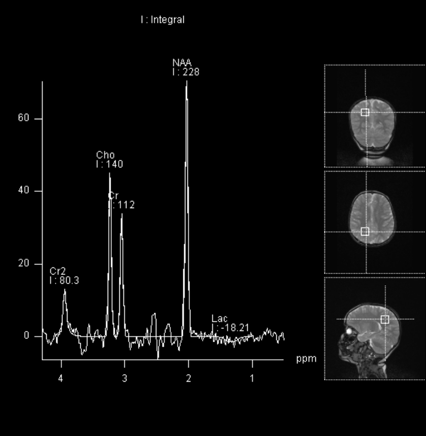 Siemens MRI Life Science MRI Facility Purdue University