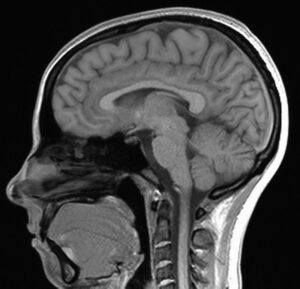 MRI images like this one inform autism neurological research in Professor Brandon Keehn's lab.