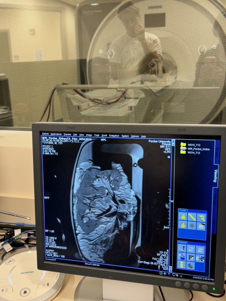 An image of a kidney inside Purdue Life Science MRI Facility.