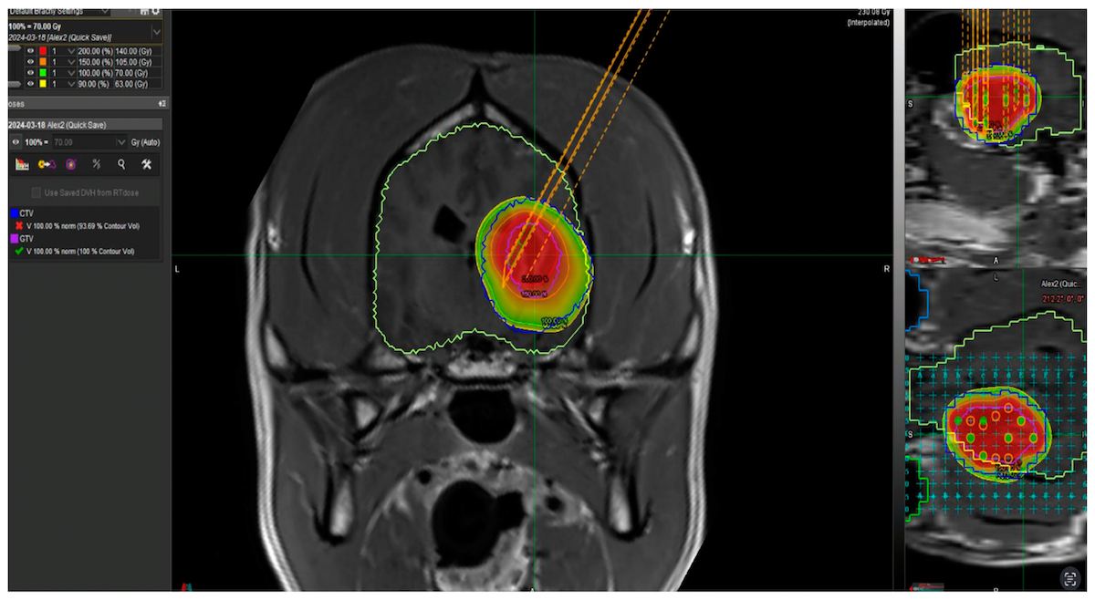 A scan of a dog's brain where a tumor was and will be treated with cesium-131