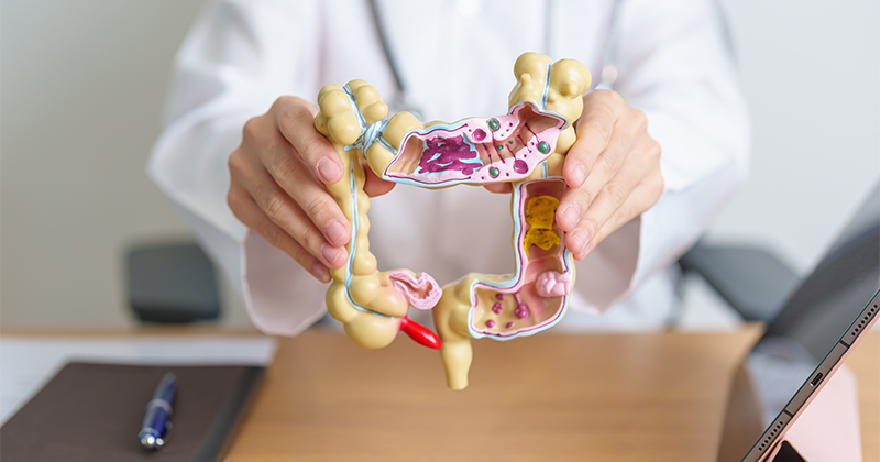 A doctor holds a model colon while sitting at a desk (Adobe Stock image).