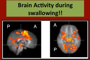 Brain Activity during swallowing
