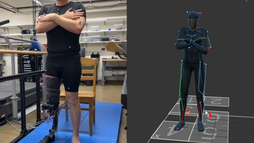 Man with prosthetic sensor