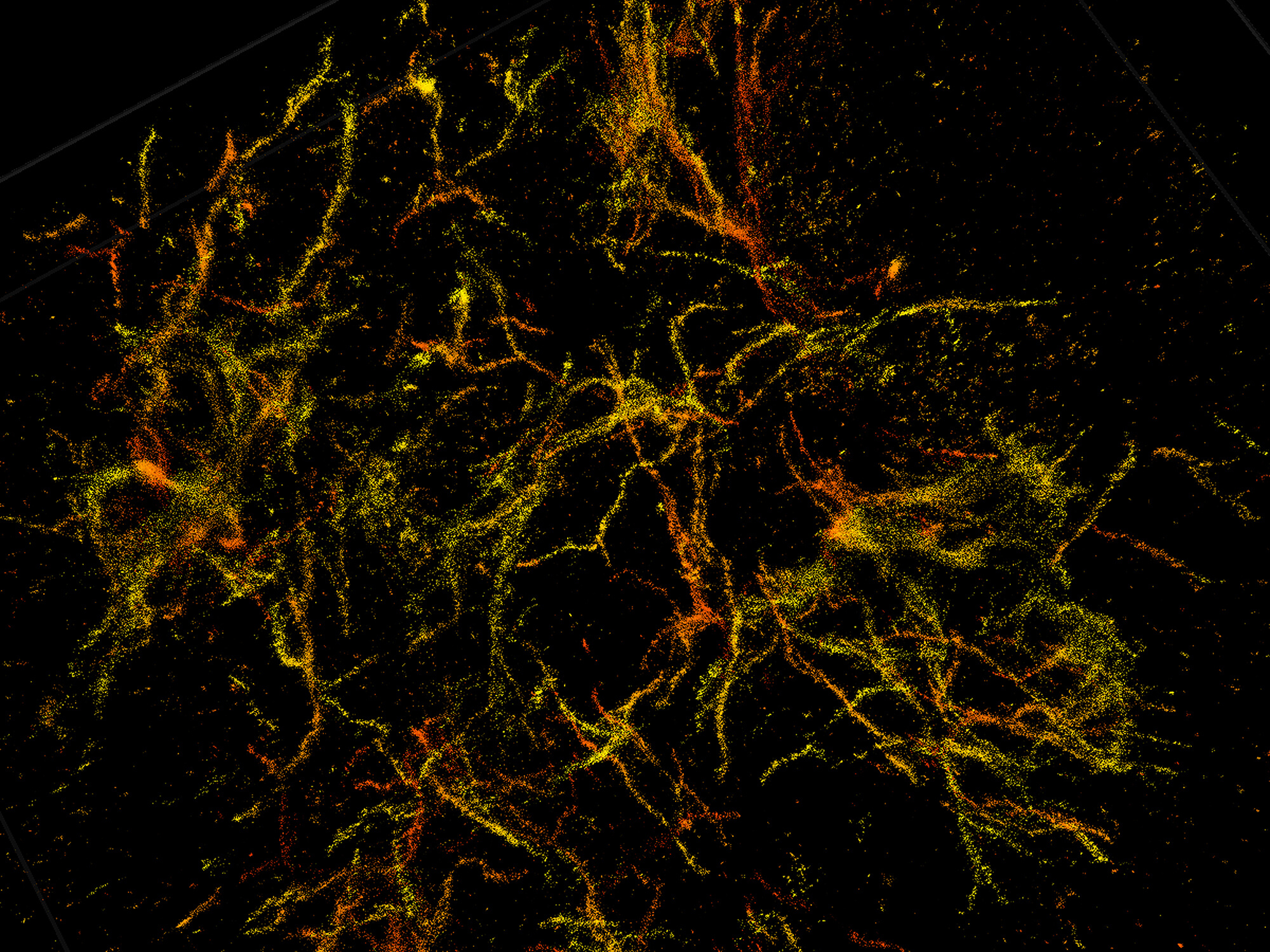 Nanoscope shows amyloid plaques of Alzheimer’s in high resolution ...
