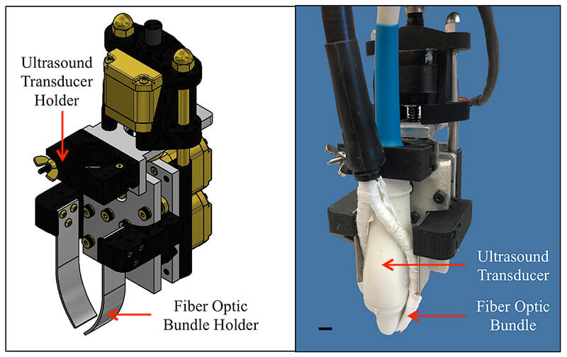 Ultrasound transducer