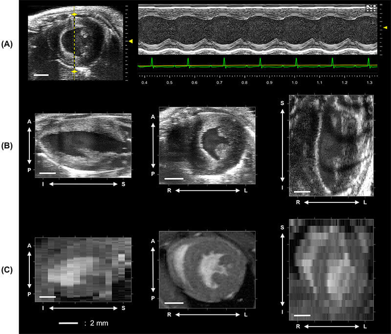 4d ultrasound