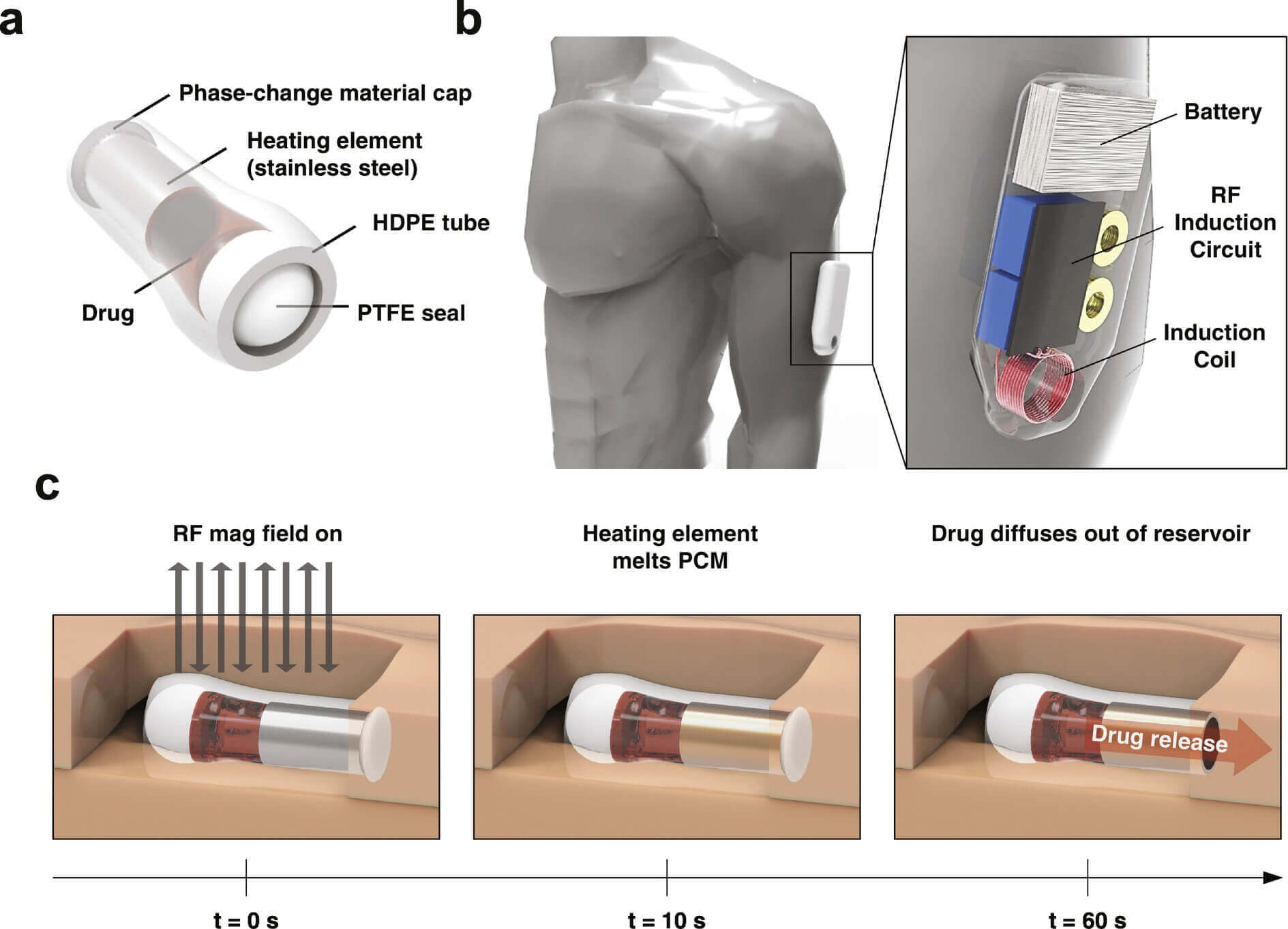 How to Use Narcan to Reverse an Opioid Overdose