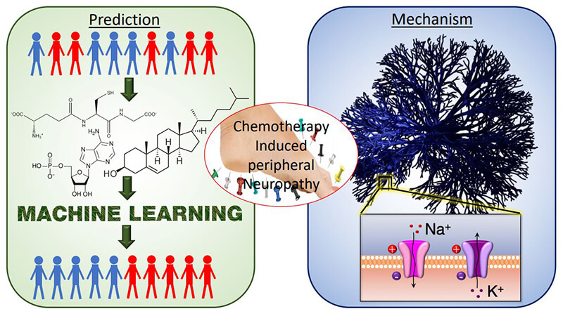 neuropathy schematic