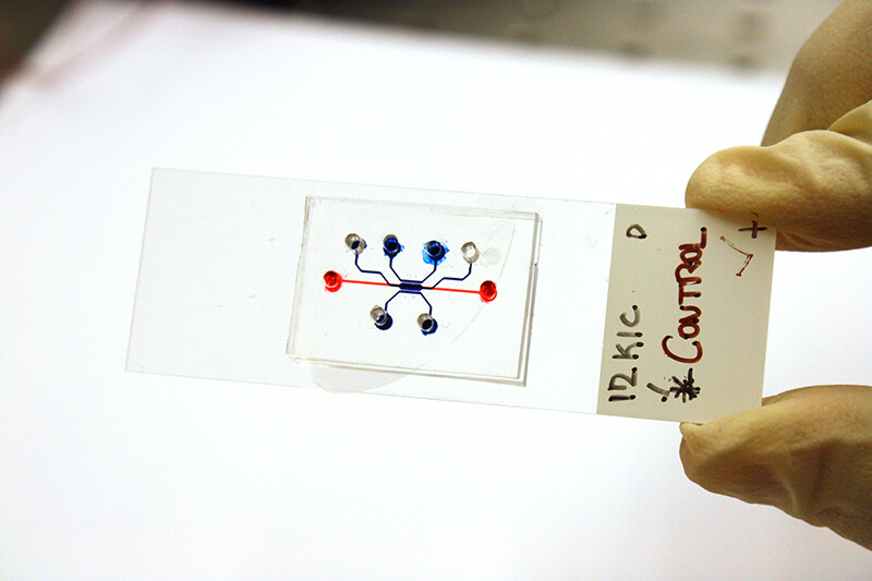 microfluidic-pancreatic-tumor-device