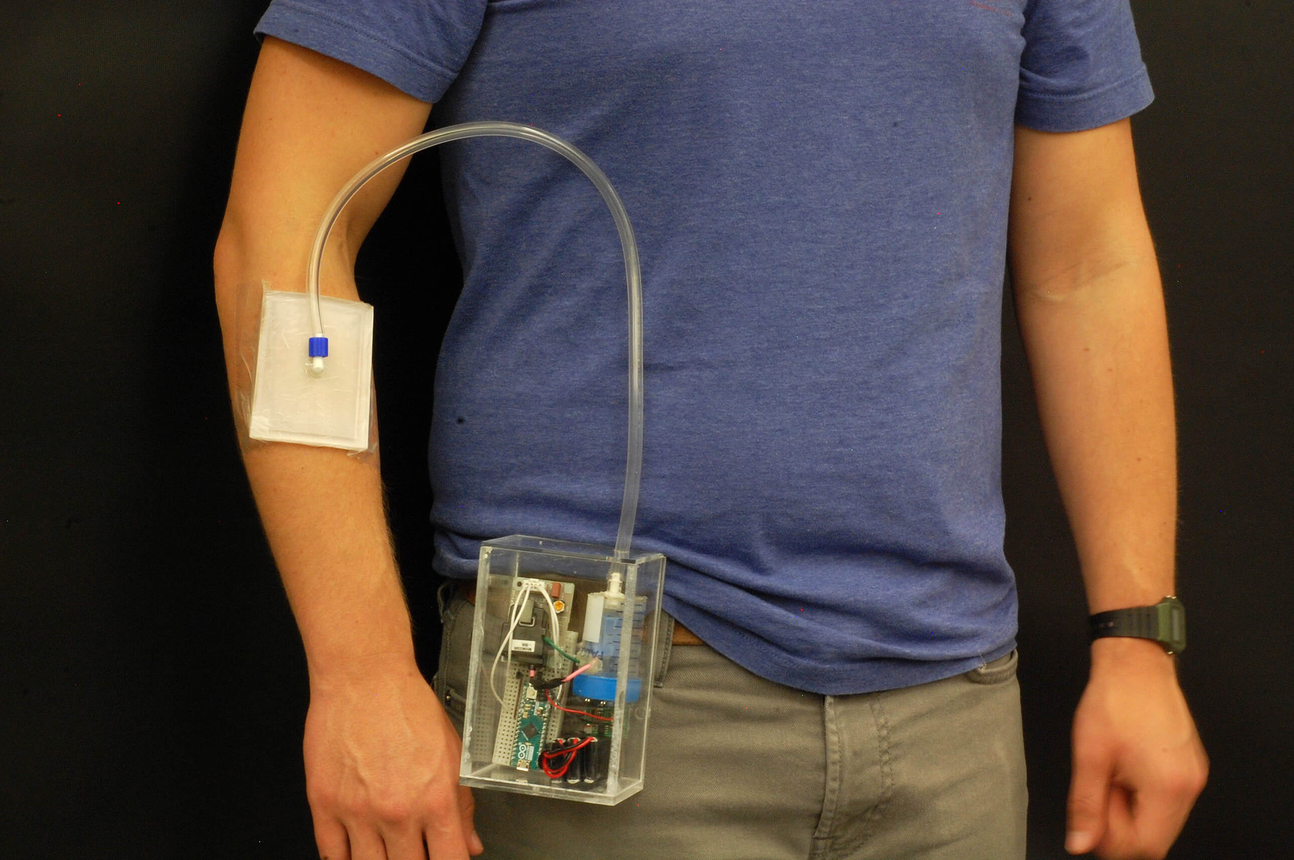 Wearable, portable invention offers options for treating antibiotic-resistant  infections, wounds - Purdue University News