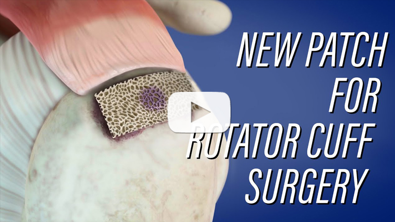 rotator cuff patch graphic