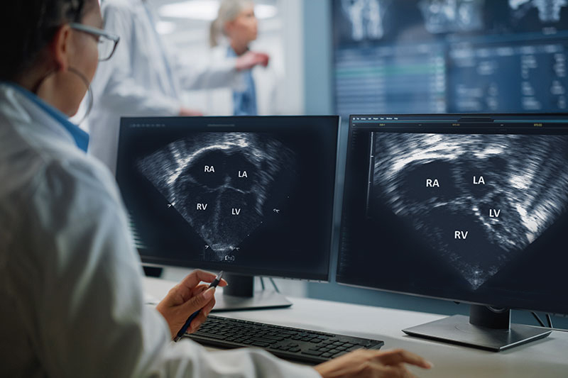 Echocardiograms of two baby hearts